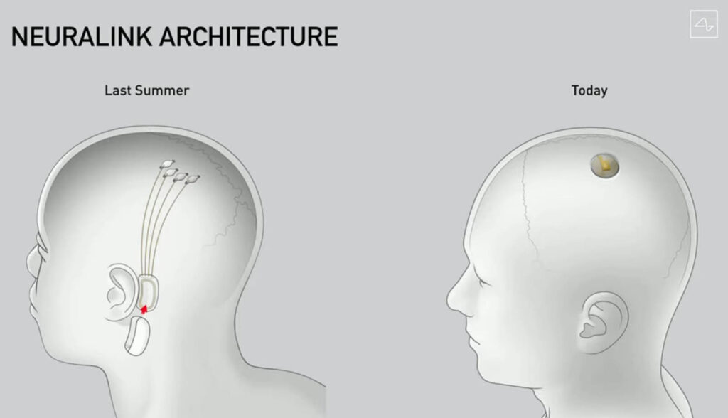 Neuralink Architecture from last year to this year